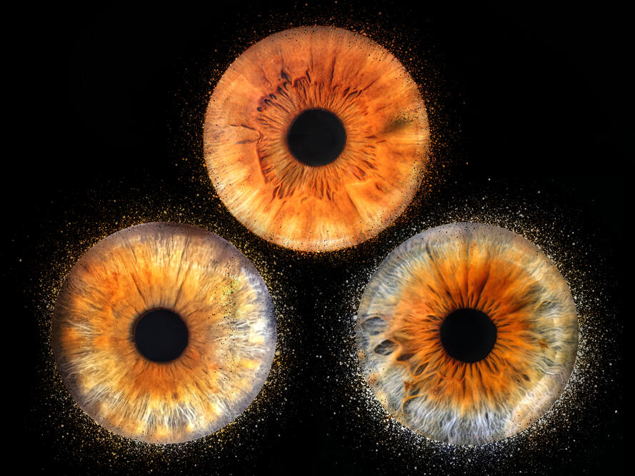 séance Iris photo studio Guebwiller montage tableau oeil